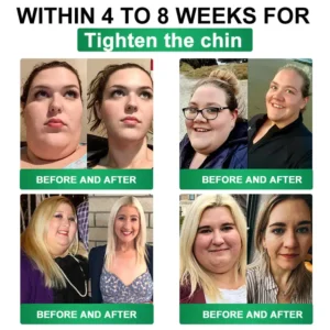 ⭐🇺🇸 Compliant with U.S. health standards · 👩‍⚕️ Recommended by U.S. medical professionals | 🎁 𝐕𝐢𝐭𝐚𝐑𝐚𝐜𝐞® 𝐒𝐮𝐩𝐞𝐫𝐟𝐨𝐨𝐝 𝐍𝐚𝐧𝐨-𝐍𝐞𝐞𝐝𝐥𝐞 𝐌𝐞𝐭𝐚𝐛𝐨𝐥𝐢𝐬𝐦 𝐏𝐚𝐭𝐜𝐡 for a Slim and Healthy Lifestyle